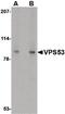 VPS53 Subunit Of GARP Complex antibody, PA5-20548, Invitrogen Antibodies, Western Blot image 