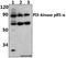 Phosphoinositide-3-Kinase Regulatory Subunit 1 antibody, A00318Y607, Boster Biological Technology, Western Blot image 
