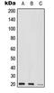 Mediator Complex Subunit 9 antibody, LS-C353834, Lifespan Biosciences, Western Blot image 