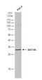 SIAT4 antibody, NBP1-31449, Novus Biologicals, Western Blot image 