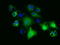 Pantothenate Kinase 2 antibody, TA501355, Origene, Immunofluorescence image 