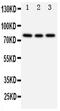 Phosphoinositide-3-Kinase Regulatory Subunit 2 antibody, PA5-79822, Invitrogen Antibodies, Western Blot image 