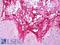 Collagen Type III Alpha 1 Chain antibody, LS-B7349, Lifespan Biosciences, Immunohistochemistry paraffin image 