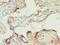 Inositol-Tetrakisphosphate 1-Kinase antibody, LS-C675922, Lifespan Biosciences, Immunohistochemistry paraffin image 