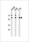 Acetylcholinesterase antibody, MBS9209945, MyBioSource, Western Blot image 