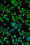 Cystatin A antibody, 19-793, ProSci, Immunofluorescence image 