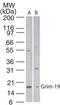 NADH dehydrogenase [ubiquinone] 1 alpha subcomplex subunit 13 antibody, PA1-41620, Invitrogen Antibodies, Western Blot image 