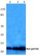 BCL2 Associated Agonist Of Cell Death antibody, A03520S136, Boster Biological Technology, Western Blot image 
