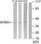 Collagen Type IX Alpha 2 Chain antibody, PA5-38886, Invitrogen Antibodies, Western Blot image 