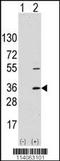 SSRA antibody, TA302066, Origene, Western Blot image 