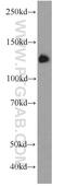 Transmembrane Protein 168 antibody, 22527-1-AP, Proteintech Group, Western Blot image 