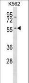Keratin 6A antibody, LS-C165631, Lifespan Biosciences, Western Blot image 