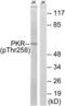 Eukaryotic Translation Initiation Factor 2 Alpha Kinase 2 antibody, LS-C199468, Lifespan Biosciences, Western Blot image 