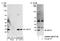 Ubiquitin Conjugating Enzyme E2 L3 antibody, NB100-2265, Novus Biologicals, Western Blot image 