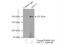 Activating signal cointegrator 1 complex subunit 3 antibody, 17627-1-AP, Proteintech Group, Immunoprecipitation image 