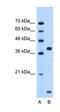 FXYD Domain Containing Ion Transport Regulator 5 antibody, orb329821, Biorbyt, Western Blot image 