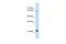 Recombining binding protein suppressor of hairless-like protein antibody, A14432, Boster Biological Technology, Western Blot image 