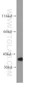 NF-kappa-B inhibitor alpha antibody, 18220-1-AP, Proteintech Group, Western Blot image 