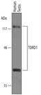 Tudor Domain Containing 1 antibody, AF6296, R&D Systems, Western Blot image 