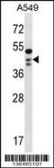 STN1 Subunit Of CST Complex antibody, 58-735, ProSci, Western Blot image 