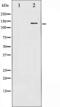 BCAR1 Scaffold Protein, Cas Family Member antibody, abx010316, Abbexa, Western Blot image 