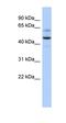 ADAM Metallopeptidase Domain 7 antibody, orb330716, Biorbyt, Western Blot image 