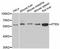 Phosphatase And Tensin Homolog antibody, abx126425, Abbexa, Western Blot image 