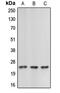 Cerebellin 2 Precursor antibody, MBS822242, MyBioSource, Western Blot image 