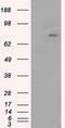 Bruton Tyrosine Kinase antibody, M00245-2, Boster Biological Technology, Western Blot image 