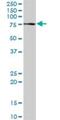 Proprotein Convertase Subtilisin/Kexin Type 2 antibody, H00005126-D01P, Novus Biologicals, Western Blot image 