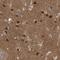 Coronin 2B antibody, NBP1-85567, Novus Biologicals, Immunohistochemistry frozen image 