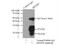 Mediator Complex Subunit 30 antibody, 16787-1-AP, Proteintech Group, Immunoprecipitation image 