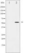 SMAD2 antibody, abx011714, Abbexa, Western Blot image 