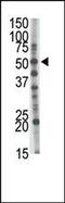 Glucosaminyl (N-Acetyl) Transferase 1 antibody, 61-377, ProSci, Western Blot image 