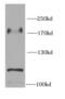 EGFR antibody, FNab02668, FineTest, Western Blot image 