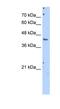 Glutamic-Oxaloacetic Transaminase 1 antibody, NBP1-54778, Novus Biologicals, Western Blot image 