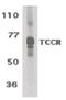 Interleukin 27 Receptor Subunit Alpha antibody, orb87324, Biorbyt, Western Blot image 