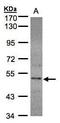 Selenide, water dikinase 2 antibody, PA5-21878, Invitrogen Antibodies, Western Blot image 