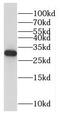Nedd4 Family Interacting Protein 1 antibody, FNab05602, FineTest, Western Blot image 