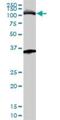 Minichromosome Maintenance Complex Component 3 antibody, H00004172-M01, Novus Biologicals, Western Blot image 