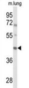 Iroquois Homeobox 2 antibody, abx034395, Abbexa, Western Blot image 