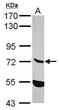 Ectonucleoside triphosphate diphosphohydrolase 7 antibody, GTX120593, GeneTex, Western Blot image 