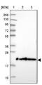 Transmembrane Protein 126A antibody, NBP2-13444, Novus Biologicals, Western Blot image 