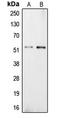 Carboxypeptidase E antibody, LS-C352036, Lifespan Biosciences, Western Blot image 