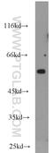 Chaperonin Containing TCP1 Subunit 3 antibody, 10571-1-AP, Proteintech Group, Western Blot image 