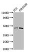 CAPS2 antibody, CSB-PA861167LA01HU, Cusabio, Western Blot image 