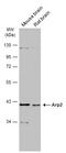 Actin Related Protein 2 antibody, GTX103311, GeneTex, Western Blot image 