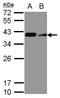 CD20 antibody, GTX100209, GeneTex, Western Blot image 