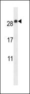 Epithelial Membrane Protein 2 antibody, LS-B8772, Lifespan Biosciences, Western Blot image 