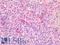 CD40 Molecule antibody, LS-A12438, Lifespan Biosciences, Immunohistochemistry paraffin image 